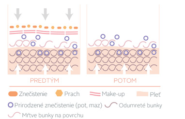 Čistenie